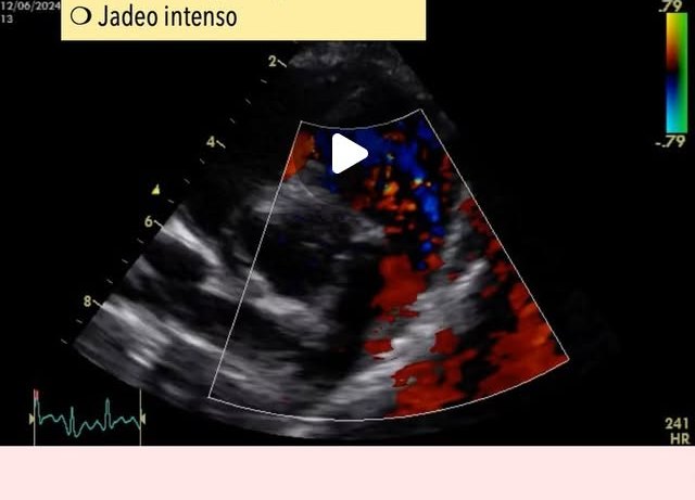 Doppler color de un corazón veterinario